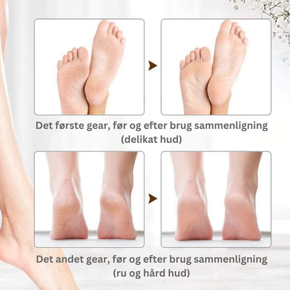 PediLuxe™ V2 Pro | Sig farvel til dyre salonbesøg – opnå glatte, bløde fødder på få minutter, nemt derhjemme!