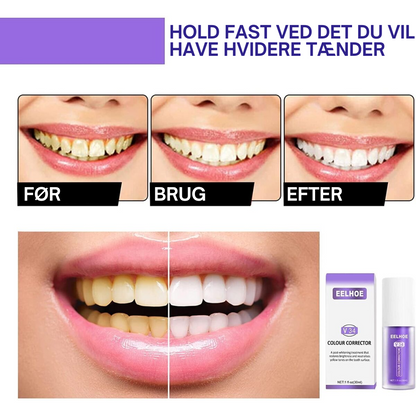 Lys Smil™ | Sig farvel til misfarvning – sig hej til et lysere smil!