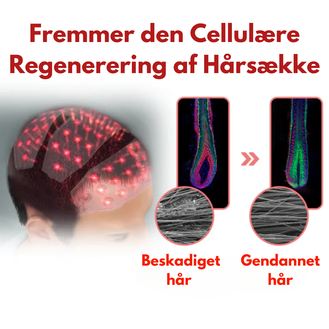 HårGlød Pro™ - Infrarød Hårterapi Kasket | Stimuler hårvækst, reducer brud og revitaliser dit hår med den beroligende varme fra avanceret infrarød teknologi.