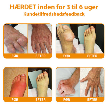 Furzero V3 Pro™ | Bi-gift smertelindrende og ledhelende creme. Anbefalet af Dansk Ortopædisk Selskab (DOS)!
