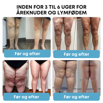 SlimFusion Pro™ - Boost din forbrænding og tab 5 kg på 7 dage med klinisk beviste resultater!